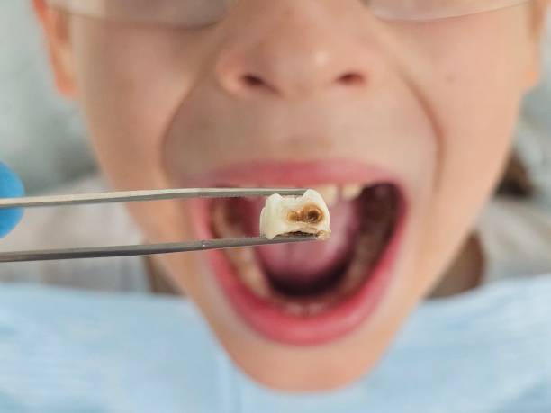 Best Emergency Treatment for Jaw Pain or Injury in Dunn Loring, VA